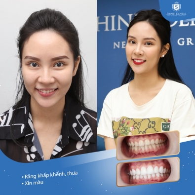 Khách hàng Hoàng Vân